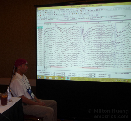 Picture of Milton getting EEG with cap and display on screen